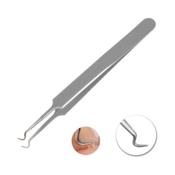Blackhead Remover Tool – Professional Stainless Steel Dual-Ended Extractor with Precision Tips & Ergonomic Grip for Safe Blackhead & Blemish Removal
